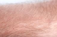 Body hair (Image via Medical News Today)